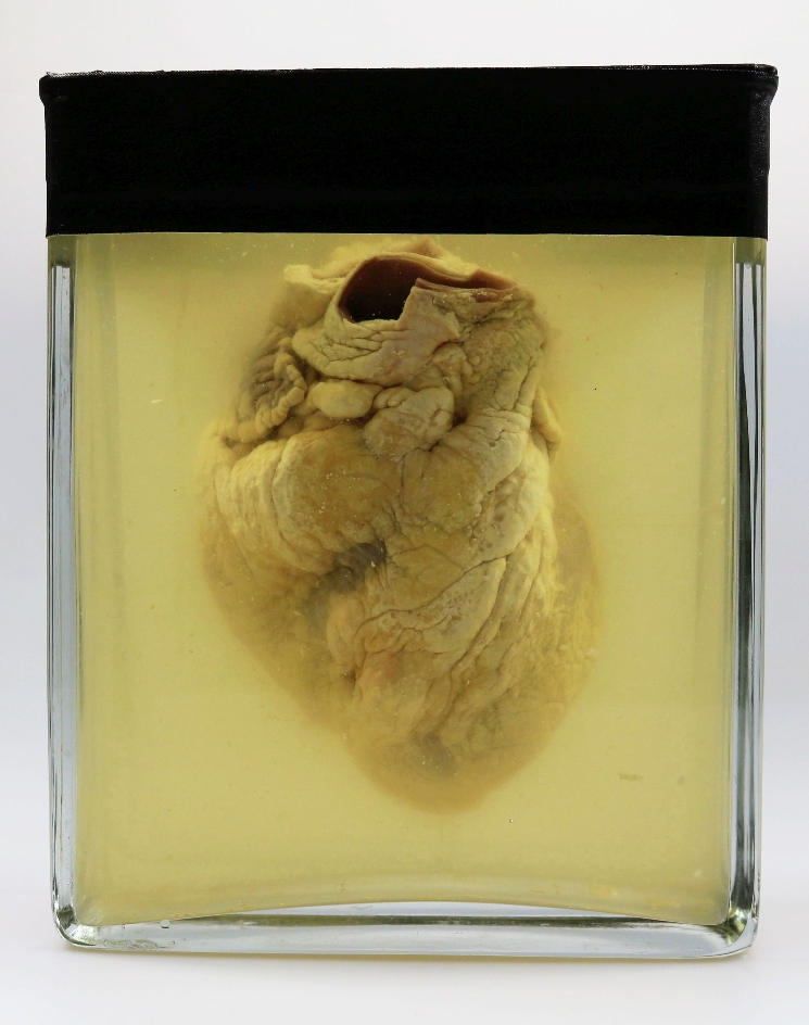 Zu sehen ist ein durchschossenes Herz in einem Glas mit Konservierungsflüssigkeit. Am Herz ist eine Stelle zu erkenn die von einer Kugel durchschlagen wurde.