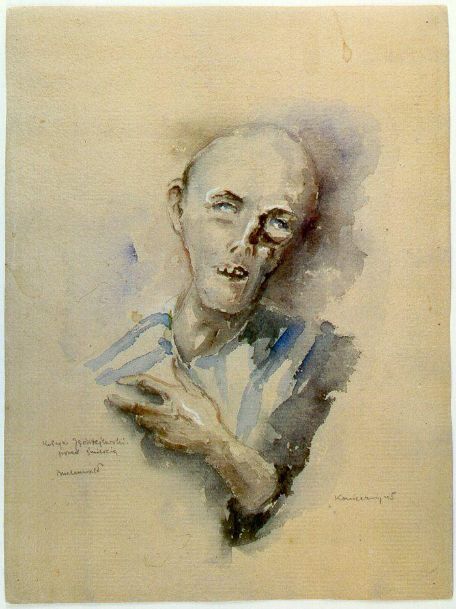 Ein Portrait mit einem extrem ausgemergelten Gesicht eines Sterbenden mit ins Leere gehenden Augen und geöffnetem Mund; eine Hand ist auf die Brust gelegt. 